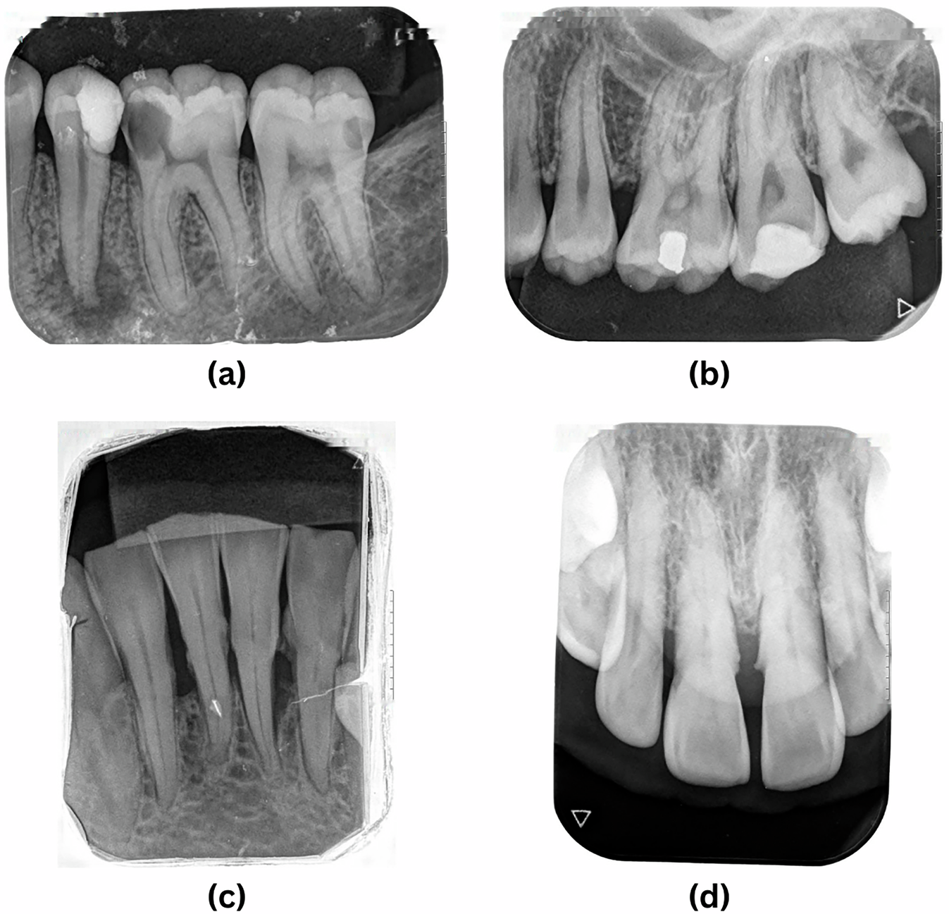 Traditional 2D dental X-ray — flat single-angle film showing teeth and bone at Frisco Dental Hub Frisco TX