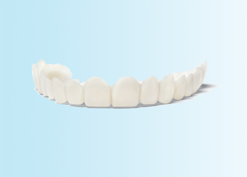 Snap-On Smile custom removable dental appliance at Frisco Dental Hub — full arch of natural-looking white teeth with shadow detail that snaps over existing teeth for instant smile transformation with no drilling in Frisco TX 75035 by UCSF-trained Dr. Nannapaneni DDS serving Frisco, Plano, McKinney, Allen, Prosper, Celina TX