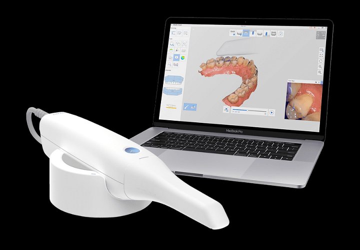 Digital wax-up treatment planning on screen showing anticipated smile rehabilitation result at Frisco Dental Hub