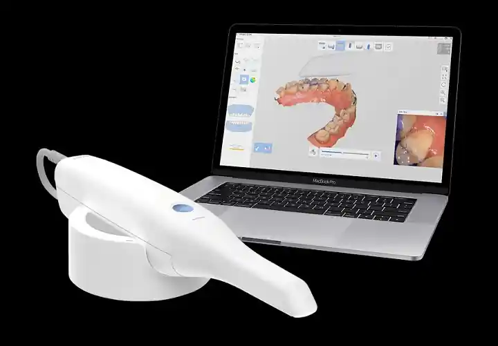 Digital wax-up treatment planning on screen showing anticipated smile rehabilitation result at Frisco Dental Hub