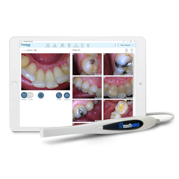 MouthWatch HD intraoral camera displaying high-definition tooth images on a tablet — patients see exactly what Dr. C sees in real time during exams at Frisco Dental Hub, Frisco TX 75035