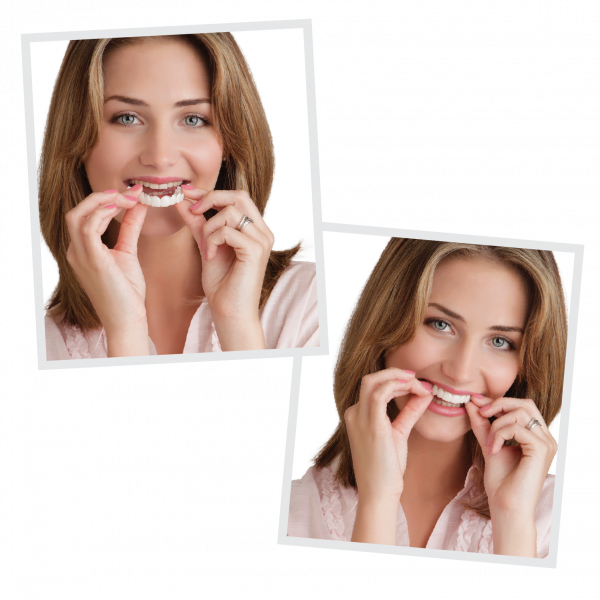 Woman inserting Snap-On Smile removable veneer appliance in Frisco TX