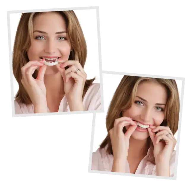 Woman inserting Snap-On Smile removable veneer appliance in Frisco TX